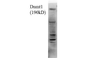 Dnmt1, 18ug H1299 lysate 1 in1000 Western Blotting. (DNMT1 Antikörper  (AA 620-950))
