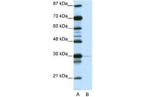 WB Suggested Anti-NANOG Antibody   Titration: 1. (Nanog Antikörper  (N-Term))