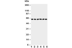 Western blot testing of PAK1 antibody and Lane 1:  rat testis
