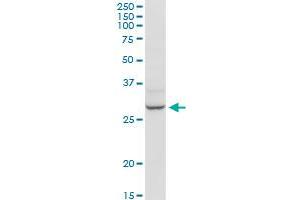 HOXB9 MaxPab rabbit polyclonal antibody. (HOXB9 Antikörper  (AA 1-250))