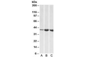 Western blot testing of A) human, B) mouse and C) rat skeletal muscle lysates with Aldolase A antibody at 1ug/ml. (ALDOA Antikörper)