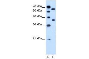 Lane A: Marker Lane B: Jurkat Cell Lysate (SLCO1A2 Antikörper  (AA 201-250))