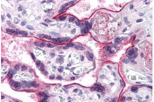 Human Placenta: Formalin-Fixed, Paraffin-Embedded (FFPE) (CDC16 Antikörper  (N-Term))