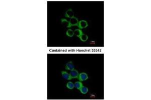 Immunofluorescence (IF) image for anti-butyrobetaine (Gamma), 2-Oxoglutarate Dioxygenase (Gamma-butyrobetaine Hydroxylase) 1 (BBOX1) (Center) antibody (ABIN2855560)