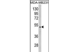Western blot analysis of GALT Antibody (C-term) (ABIN390867 and ABIN2841084) in MDA-M cell line lysates (35 μg/lane).
