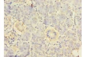 Immunohistochemistry of paraffin-embedded human pancreatic tissue using ABIN7142524 at dilution of 1:100 (RPS24 Antikörper  (AA 2-133))
