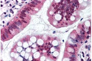 Human Small Intestine (formalin-fixed, paraffin-embedded) stained with SRI antibody ABIN290232 at 10 ug/ml followed by biotinylated goat anti-rabbit IgG secondary antibody ABIN481713, alkaline phosphatase-streptavidin and chromogen. (SRI Antikörper  (AA 50-100))