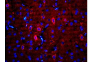 Formalin-fixed and paraffin-embedded rat brain labeled with Anti-RALDH2 Polyclonal Antibody, Unconjugatedused at 1:200 dilution for 40 minutes at 37°C. (ALDH1A2 Antikörper  (AA 441-518))