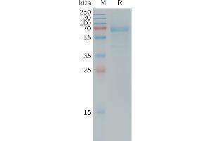 SDS-PAGE (SDS) image for Dickkopf Homolog 1 (DKK1) (AA 32-266) protein (mFc Tag) (ABIN7491413)