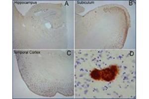 Extensive OC labeling was observed in the hippocampus (A), subiculum (B) and frontal cortex (C) in Alzheimer disease. (Amyloid Fibrils Antikörper)
