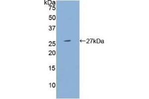 Detection of Recombinant PSG1, Human using Polyclonal Antibody to Pregnancy Specific Beta-1-Glycoprotein 1 (PSG1) (PSG1 Antikörper  (AA 202-401))