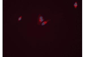 ABIN6277813 staining HEPG2 cells by ICC/IF. (GLUL Antikörper  (C-Term))