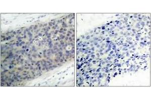 Immunohistochemistry (IHC) image for anti-LIM Domain Kinase 2 (LIMK2) (AA 471-520), (pThr505) antibody (ABIN1531897)