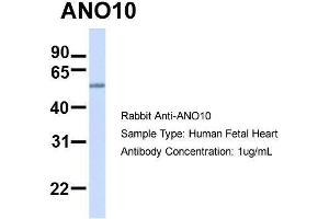 Anoctamin 10 antibody  (C-Term)