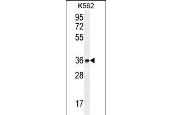 ETV2 Antikörper  (N-Term)