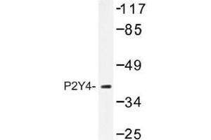 Image no. 1 for anti-Pyrimidinergic Receptor P2Y, G-Protein Coupled, 4 (P2RY4) antibody (ABIN317768) (P2RY4 Antikörper)