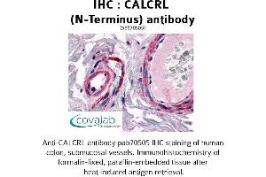 Image no. 1 for anti-Calcitonin Receptor-Like (CALCRL) (Extracellular Domain), (N-Term) antibody (ABIN1732561) (CALCRL Antikörper  (Extracellular Domain, N-Term))