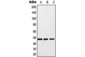 Western blot analysis of GPR173 expression in HeLa (A), mouse kidney (B), rat kidney (C) whole cell lysates.