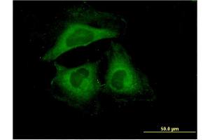 Immunofluorescence of monoclonal antibody to HSPB6 on HeLa cell.
