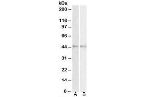 Western blot testing of mouse [A] and rat [B] eye lysates with RNF13 antibody at 2ug/ml. (RNF13 Antikörper)