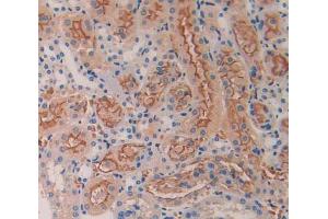 IHC-P analysis of kidney tissue, with DAB staining. (BMP5 Antikörper  (AA 201-314))
