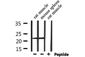 Western blot analysis of extracts from rat muscle,mouse spleen, using PRDX2 Antibody. (Peroxiredoxin 2 Antikörper  (C-Term))