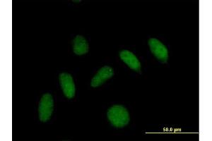Immunofluorescence of purified MaxPab antibody to PLEKHJ1 on HeLa cell. (GNRPX Antikörper  (AA 1-149))