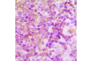 Immunohistochemical analysis of p40 phox staining in human tonsil formalin fixed paraffin embedded tissue section. (NCF4 Antikörper  (Center))