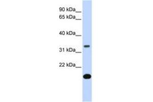 Image no. 1 for anti-Follistatin (FST) (AA 144-193) antibody (ABIN6743094) (Follistatin Antikörper  (AA 144-193))