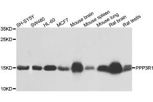 Western blot analysis of extracts of various cells, using PPP3R1 antibody.