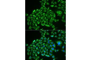 Immunofluorescence analysis of MCF-7 cells using RCVRN antibody (ABIN5973805). (Recoverin Antikörper)