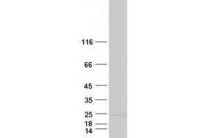 C6ORF136 Protein (Transcript Variant 2) (Myc-DYKDDDDK Tag)