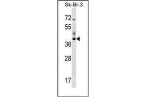 Western blot analysis of HSD17B1 Antibody (C-term) in SK-BR-3 cell line lysates (35ug/lane). (HSD17B1 Antikörper  (C-Term))
