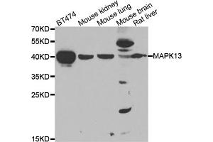 Western blot analysis of extracts of various cell lines, using MAPK13 antibody (ABIN5975574) at 1/1000 dilution. (MAPK13 Antikörper)
