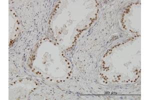 Immunoperoxidase of monoclonal antibody to CLK3 on formalin-fixed paraffin-embedded human prostate. (CLK3 Antikörper  (AA 36-136))