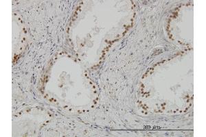Immunoperoxidase of monoclonal antibody to CLK3 on formalin-fixed paraffin-embedded human prostate.