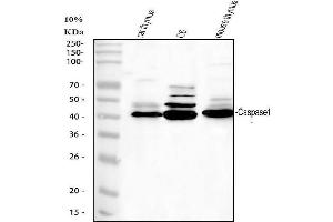 Western blot analysis of CASP1 using anti-CASP1 antibody (ABIN5518669).