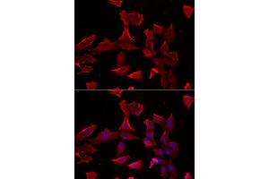 Immunofluorescence analysis of HeLa cell using ADSS antibody. (ADSS Antikörper)