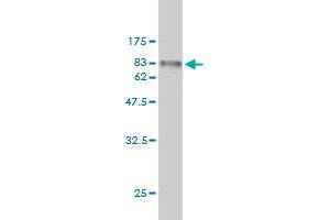 Western Blot detection against Immunogen (67. (FGFR1OP Antikörper  (AA 1-379))