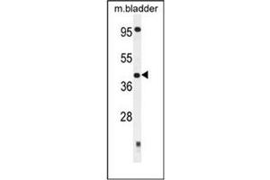 Western blot analysis of SLFNL1 Antibody (N-term) in Mouse bladder tissue lysates (35ug/lane).