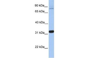 TIPIN antibody used at 0. (TIPIN Antikörper  (Middle Region))