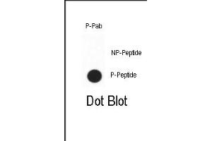 Dot Blot (DB) image for anti-Caudal Type Homeobox 2 (CDX2) (pSer283) antibody (ABIN650838)