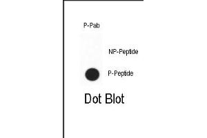Dot blot analysis of anti-Phospho-CDX2 Phospho-specific Pab (ABIN650838 and ABIN2839803)? (CDX2 Antikörper  (pSer283))