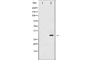 Western blot analysis of 14-3-3 zeta/ delta phosphorylation expression in UV treated Jurkat whole cell lysates,The lane on the left is treated with the antigen-specific peptide. (14-3-3 zeta Antikörper  (pThr232))