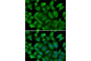 Immunofluorescence analysis of HeLa cells using DEFA1 antibody (ABIN5974152). (alpha Defensin 1 Antikörper)