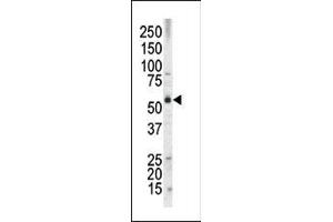 The anti-MLLT3 Pab (ABIN390130 and ABIN2840635) is used in Western blot to detect MLLT3 in HL60 tissue lysate (AF9 Antikörper  (N-Term))