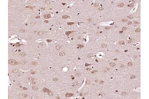 Paraformaldehyde-fixed, paraffin embedded Rat brain Antigen retrieval by boiling in sodium citrate buffer (pH6. (Caspase 6 Antikörper  (AA 181-293))