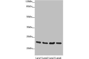 Western blot All lanes: RAB18 antibody at 0.