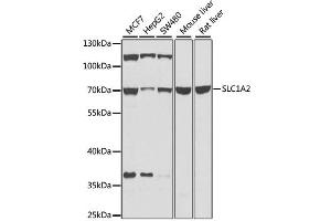 Western blot analysis of extracts of various cell lines, using SLC1A2 antibody (ABIN2736671) at 1:1000 dilution. (SLC1A2 Antikörper)
