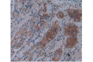 IHC-P analysis of Human Stomach Tissue, with DAB staining. (IL1A Antikörper  (AA 113-271))